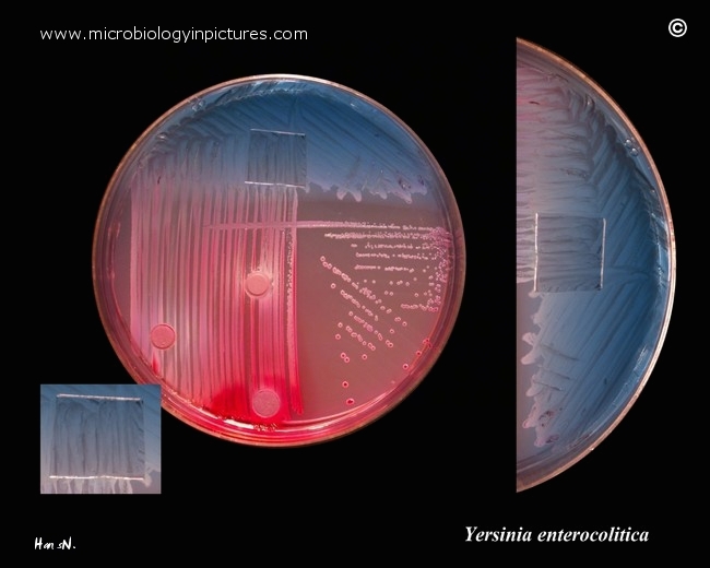 Y.enterocolitica, basic biochemical tests basic biochemical tests for identification of y.enterocolitica